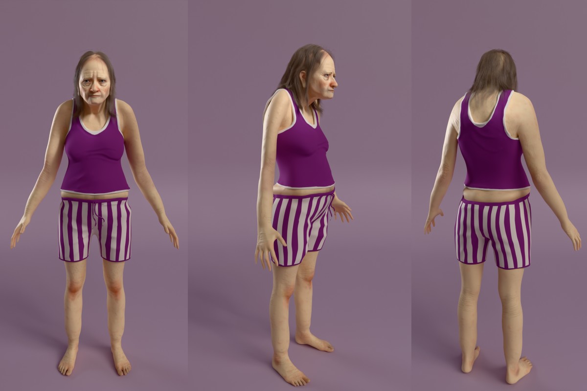 A full body front, side, and rear view composition of what a woman, aged 40, would look like after 25 years of consistently poor sleep